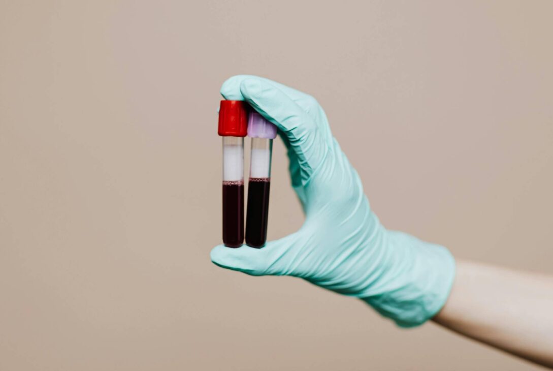 Exames de sangue para ciclistas